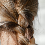 วิเคราะห์ สภาพเส้นผม Hair Diangosis