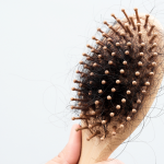 สาเหตุผมร่วง