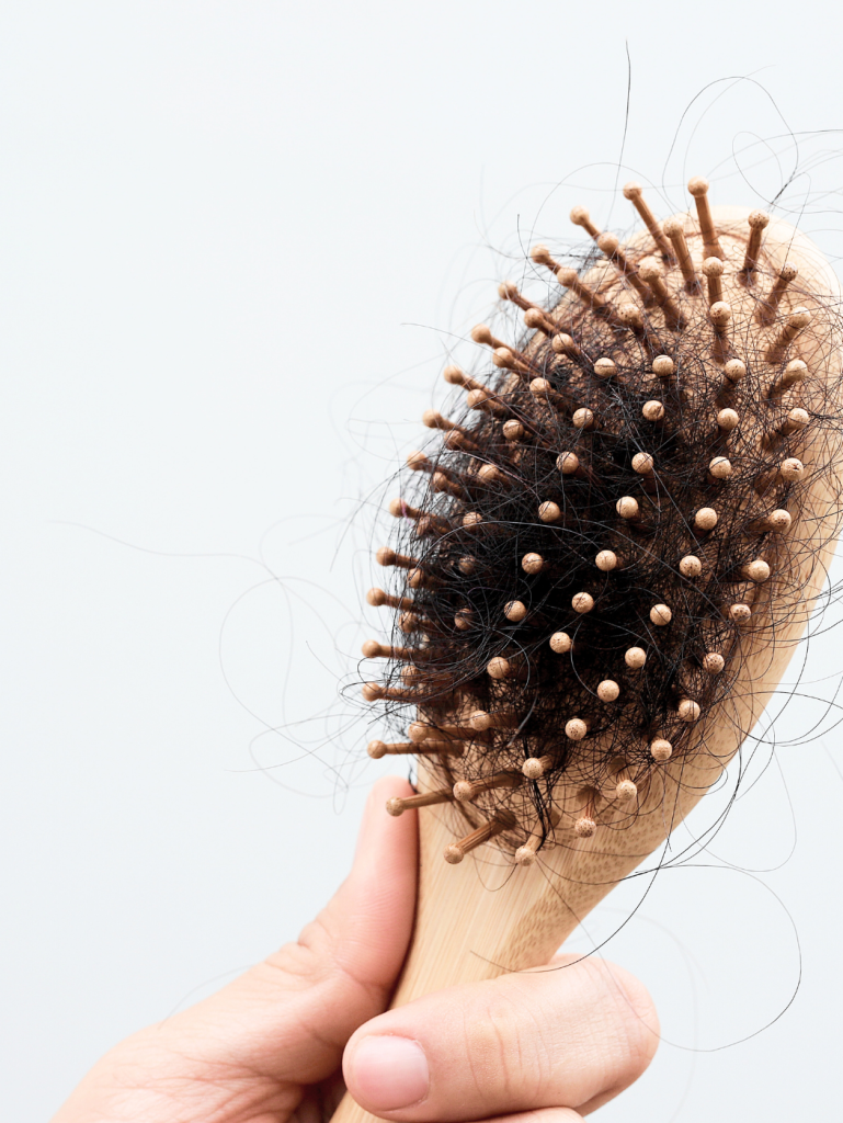 สาเหตุผมร่วง